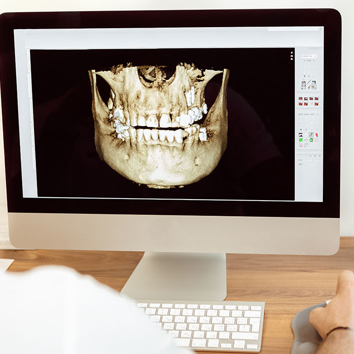 Cone Beam Technology - Dental Technology